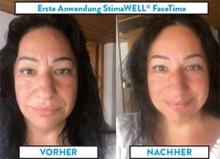 face time beauty Testemonial jana